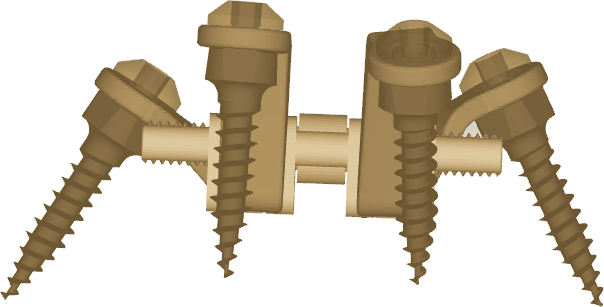 Diseño de MARPE con microtornillos